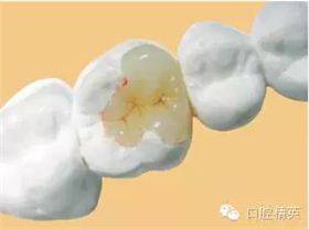 QQ图片20150711135939.png