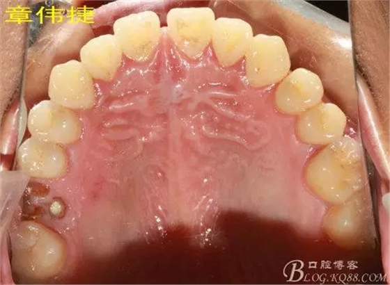 QQ图片20150711161846.png