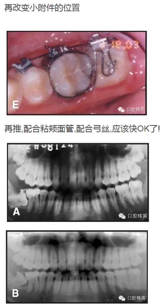 QQ图片20150713105644.png