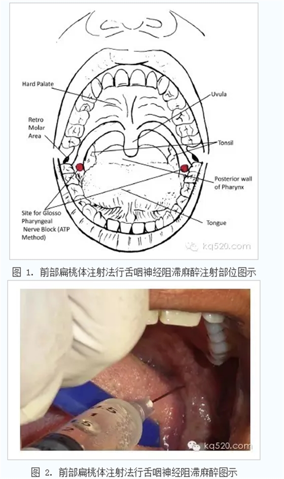 QQ图片20150715143032.png