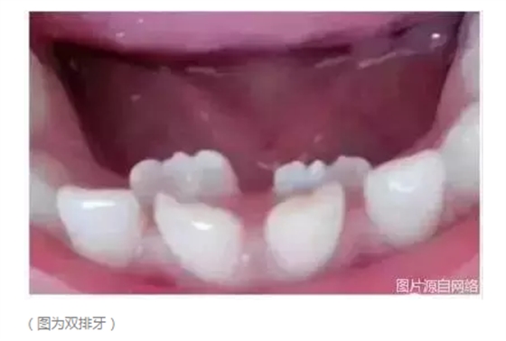 QQ图片20150716174102.png