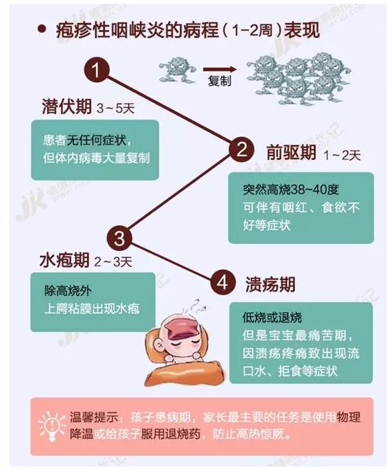 小儿疱疹性咽峡炎的治疗和预防