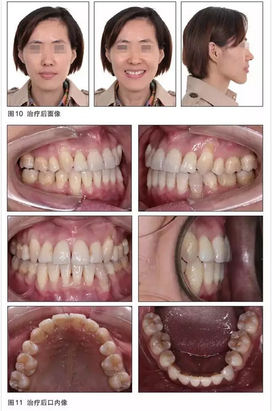 QQ图片20150724091640.png