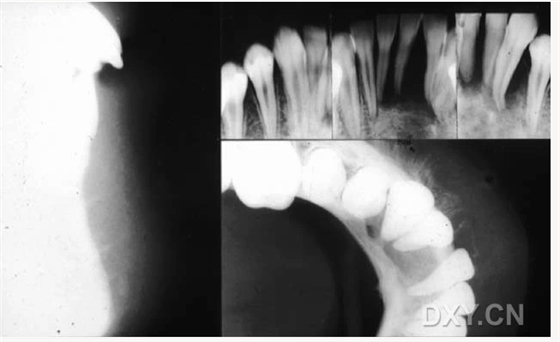 【顶级干货】口腔医生必收藏，口腔影像图片大全！