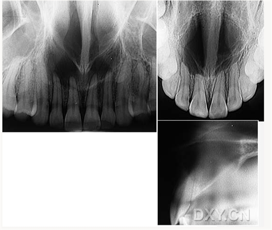 【顶级干货】口腔医生必收藏，口腔影像图片大全！