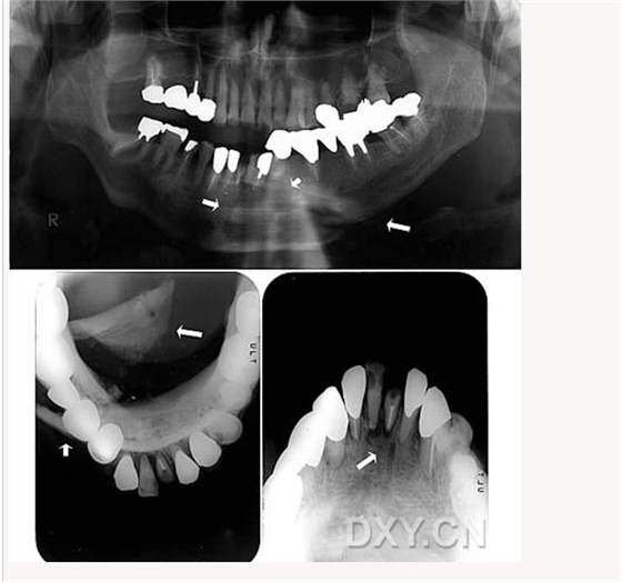 【顶级干货】口腔医生必收藏，口腔影像图片大全！