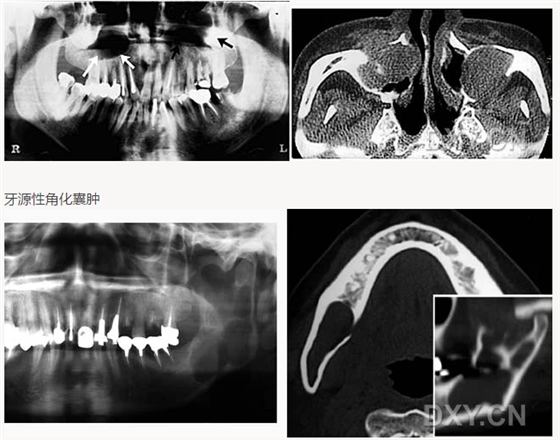 【顶级干货】口腔医生必收藏，口腔影像图片大全！