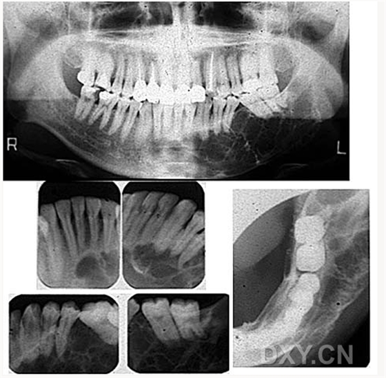 【顶级干货】口腔医生必收藏，口腔影像图片大全！