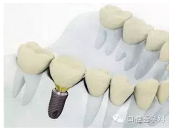 QQ图片20150808173047.png