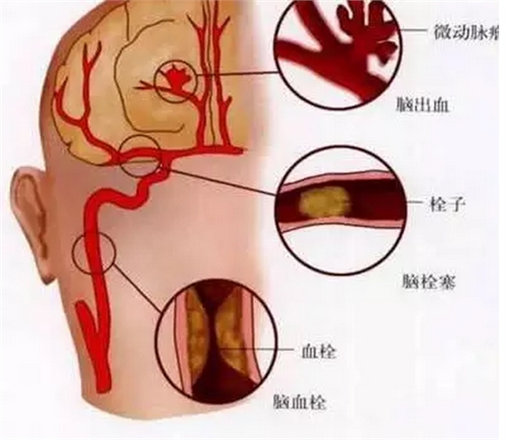 QQ图片20150812090517.png