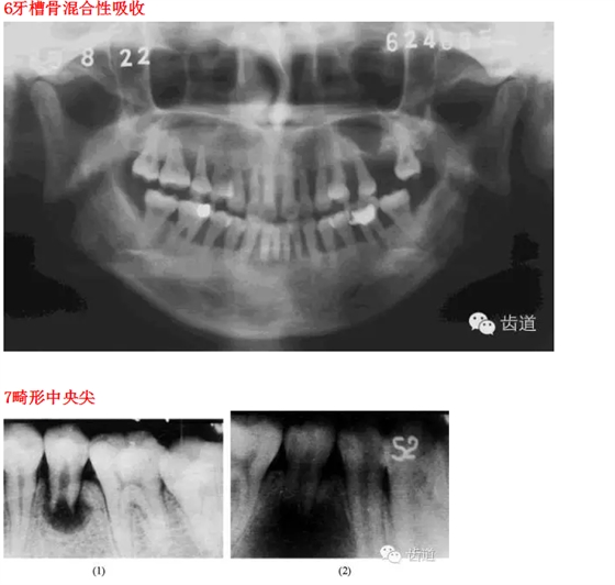 QQ图片20150812095414.png