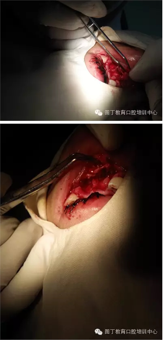 QQ图片20150813150818.png