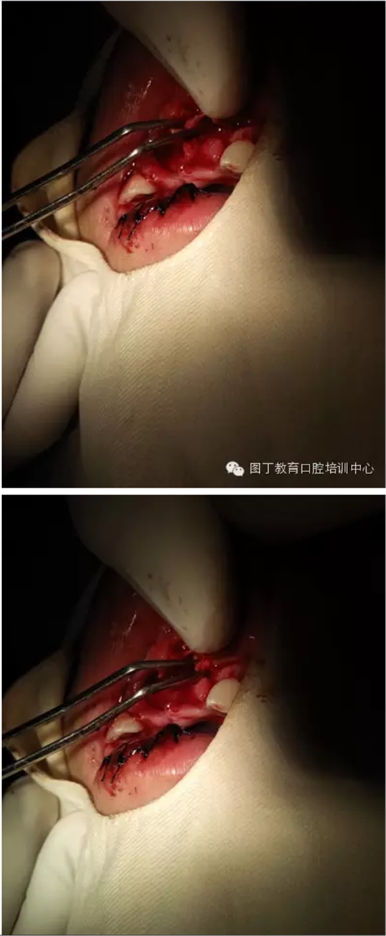 QQ图片20150813150834.png
