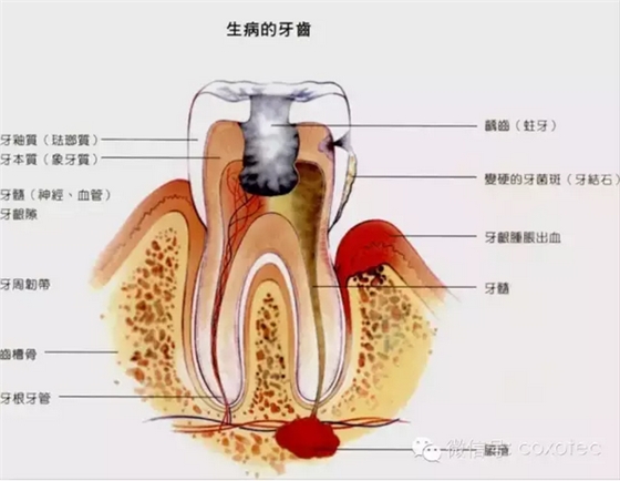 根管测量受影响的原因