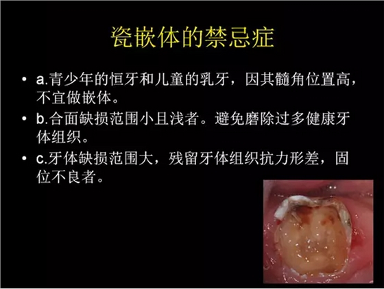 QQ图片20150818091845.png