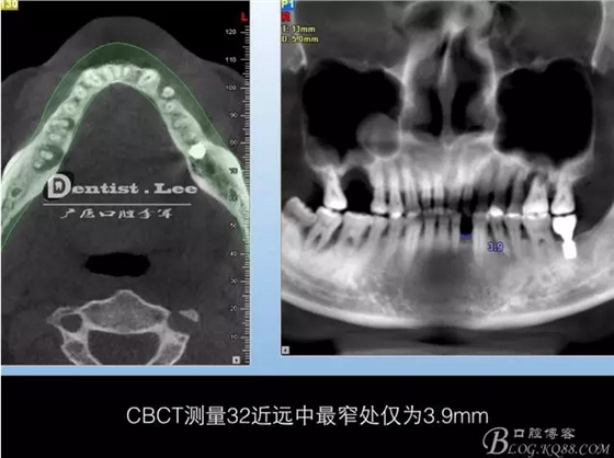 QQ图片20150818092229.png