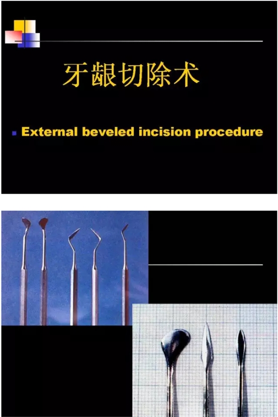 QQ图片20150819094940.png