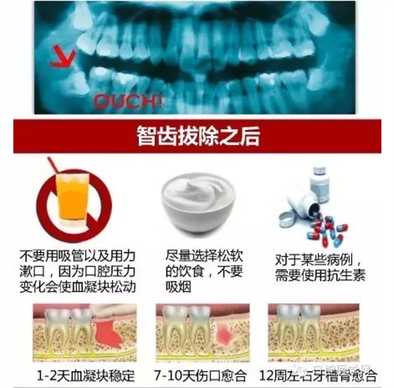 QQ图片20150824114655.png