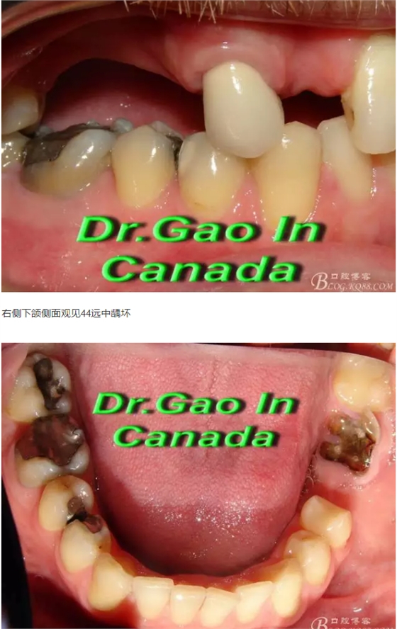 QQ图片20150824171046.png