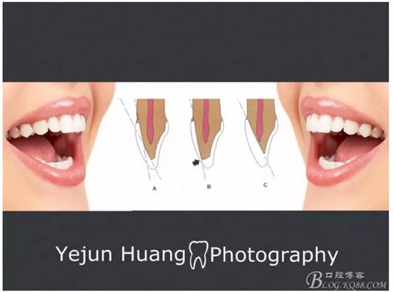 QQ图片20150824173039.png