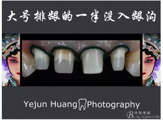 QQ图片20150824174013.png
