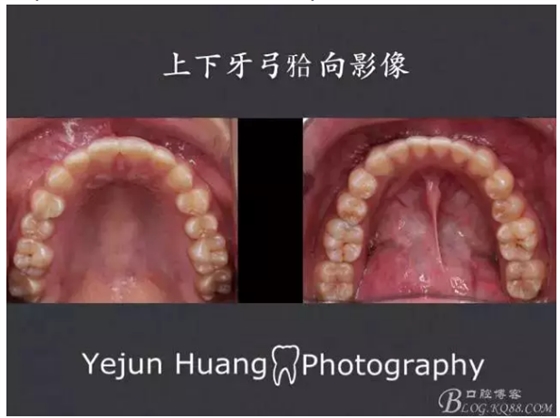 QQ图片20150824175720.png