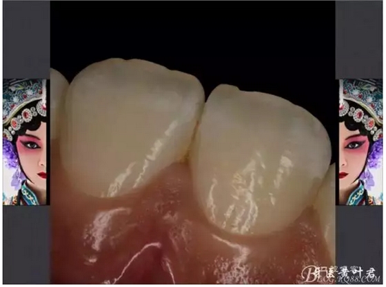 QQ图片20150824175747.png