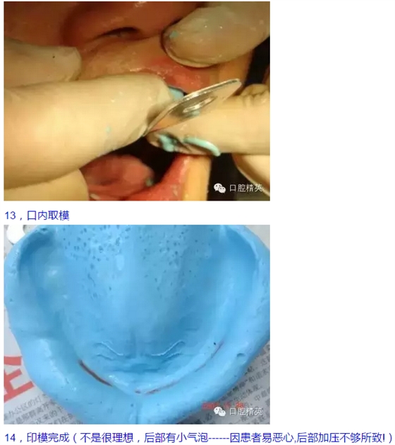 QQ图片20150825103635.png
