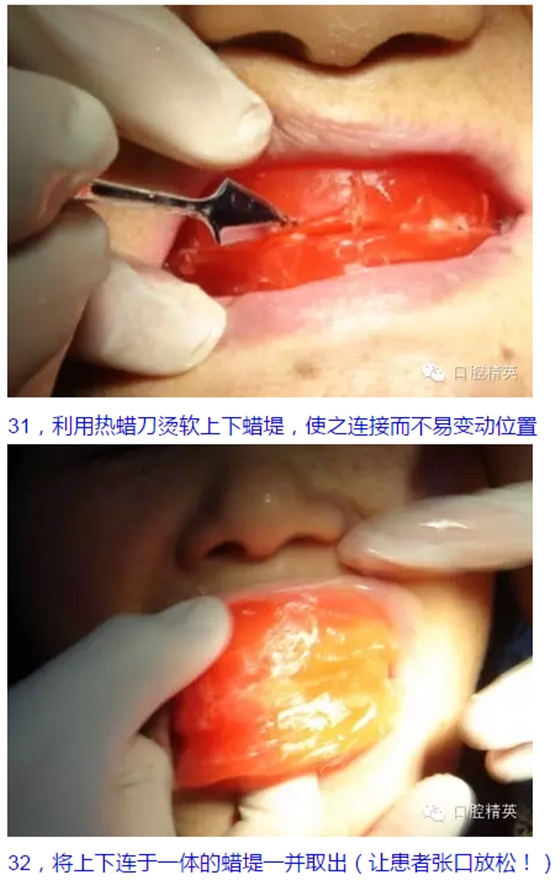 QQ图片20150825103957.png
