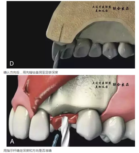 QQ图片20150825140532.png