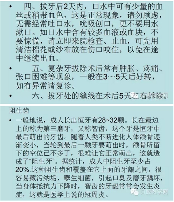 阻生齿