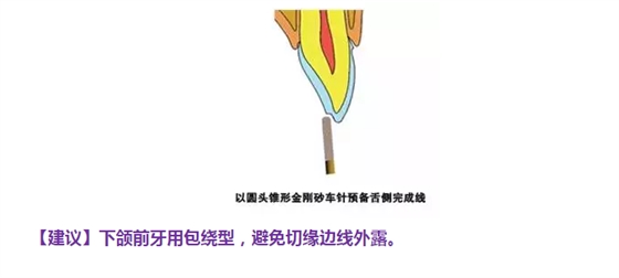 57.png