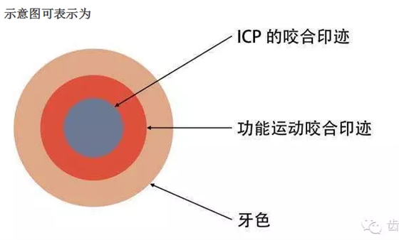 牙科咬合纸的用法