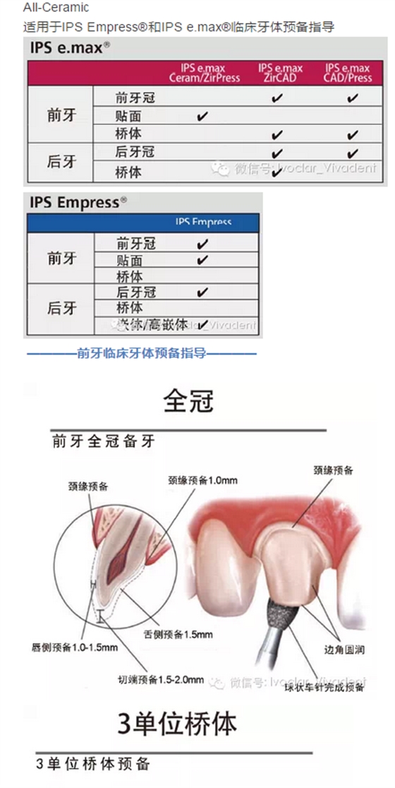 时常搞不清楚怎么备牙吗？义获嘉教您如何完美备牙