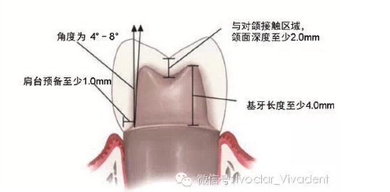 时常搞不清楚怎么备牙吗？义获嘉教您如何完美备牙