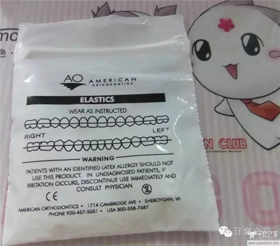 牙齿矫正过程中，有时需要正畸患者自行配戴橡皮筋，这种弹力橡皮圈(elastics)主要挂在矫治装置（托槽、牵引钩）之间，产生弹力作用于牙齿和牙弓(dental arch)。