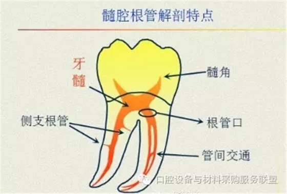 超实用的根管口的探查术