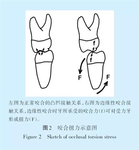 王美青.浅谈咬合修复重建中的（牙合）学问题