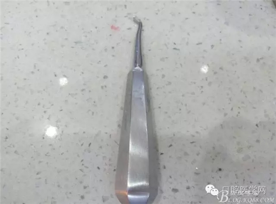 乳磨牙金属预成冠制作