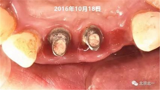 360截图20170124115210520.jpg