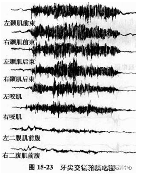 温故知新 口腔解剖生理学（35）.png