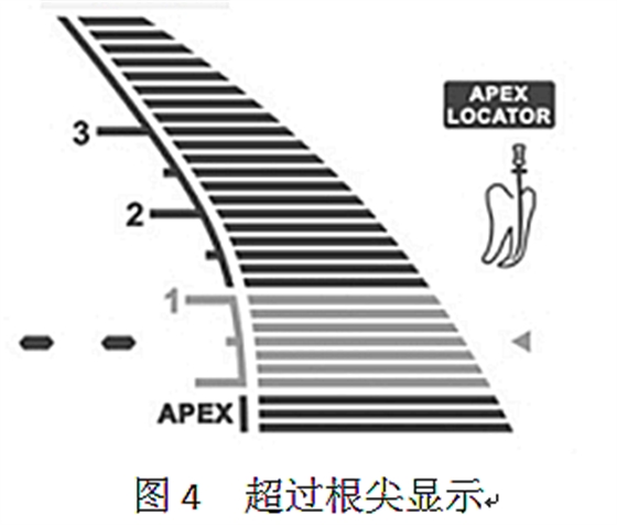 根管长度测量仪的使用