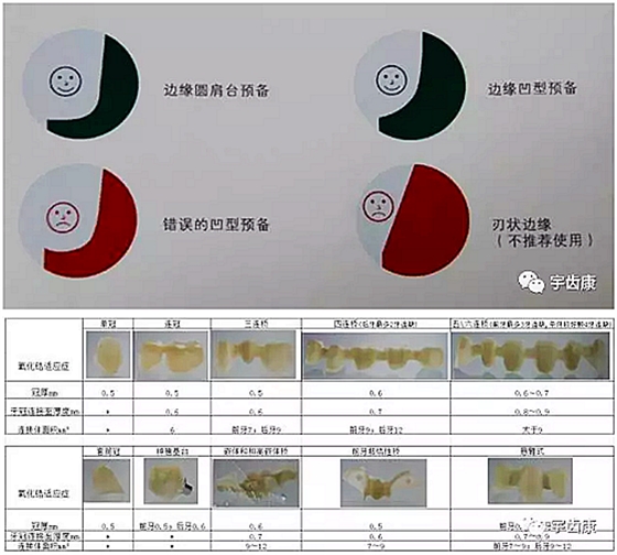 影响全瓷牙冠裂的因素有哪些？