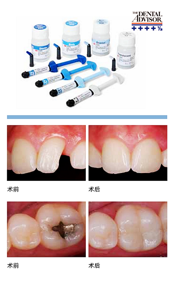 Z350XT通用纳米树脂.png