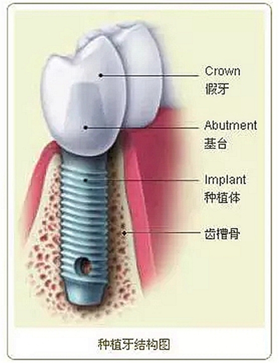 640.webp_副本.jpg