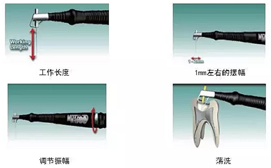 贺力氏 音波根管治疗系统