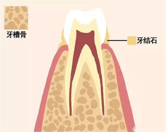 【爱牙科普】牙齿是如何脱落的…