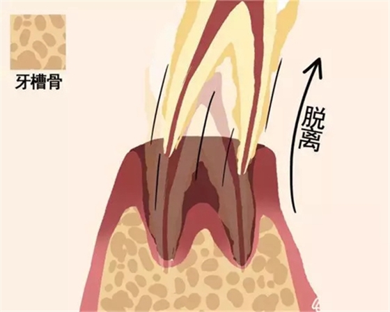 【爱牙科普】牙齿是如何脱落的…