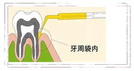 上海品瑞迈格磁致伸缩治疗仪