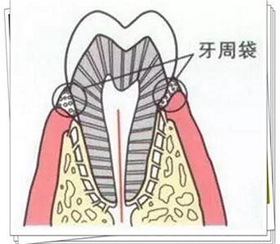 上海品瑞迈格磁致伸缩治疗仪